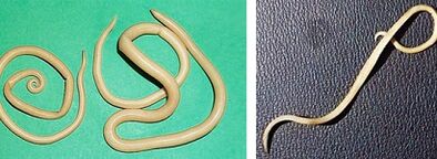 aké parazity môže mať človek